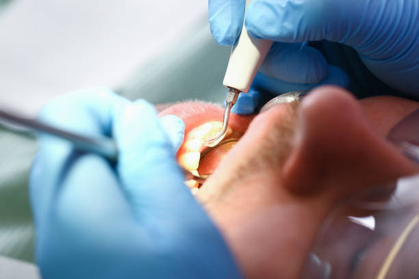 Best Emergency Dental Care for Broken or Chipped Teeth in Commerce, TX