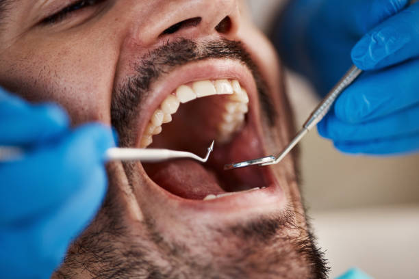 Best Emergency Treatment for Dental Infections or Abscesses in Commerce, TX