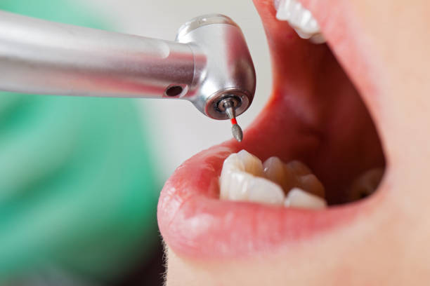 Best Weekend Emergency Dentist in Commerce, TX